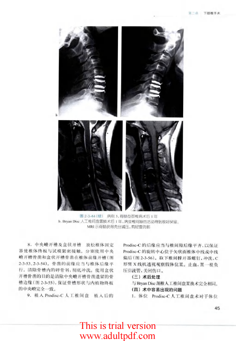 脊柱外科手术操作与技巧（骨科手术技巧丛书）2.pdf 第1页