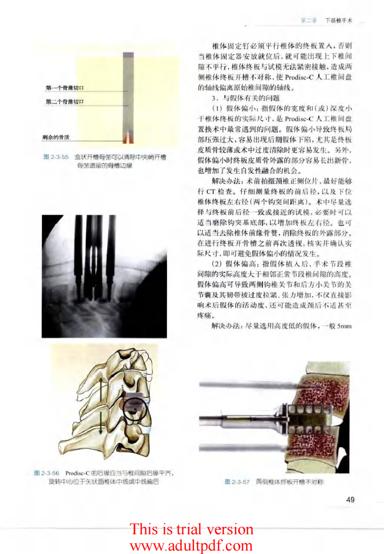 脊柱外科手术操作与技巧（骨科手术技巧丛书）2.pdf 第5页