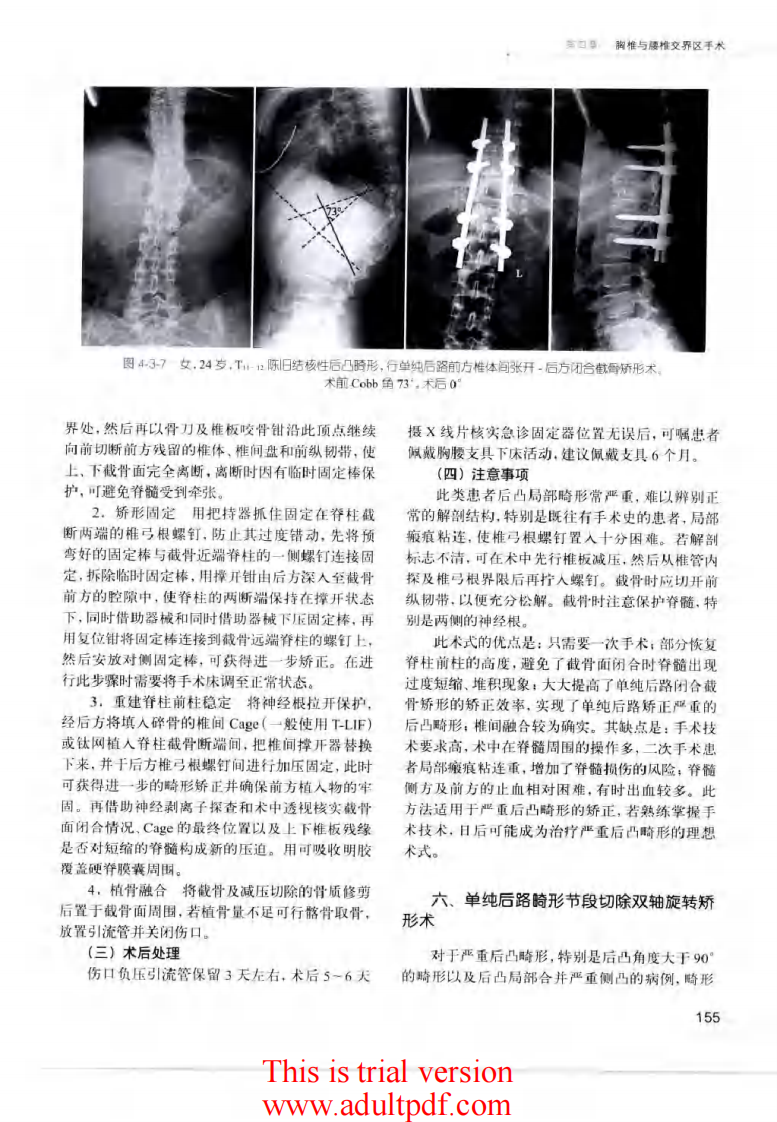 脊柱外科手术操作与技巧（骨科手术技巧丛书）4.pdf 第1页