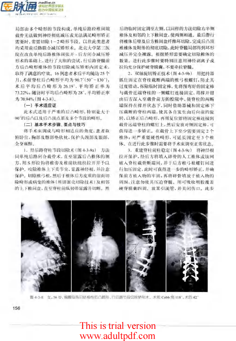 脊柱外科手术操作与技巧（骨科手术技巧丛书）4.pdf 第2页