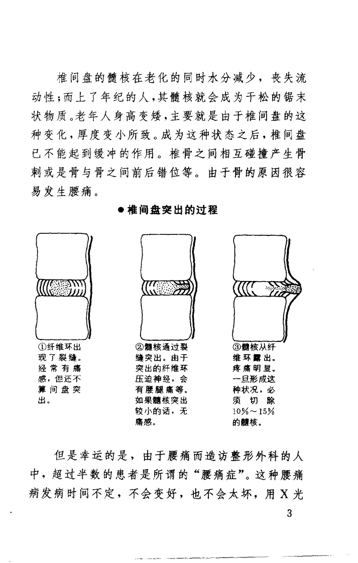 治疗腰痛100法（日）（扫描版）.pdf 第2页