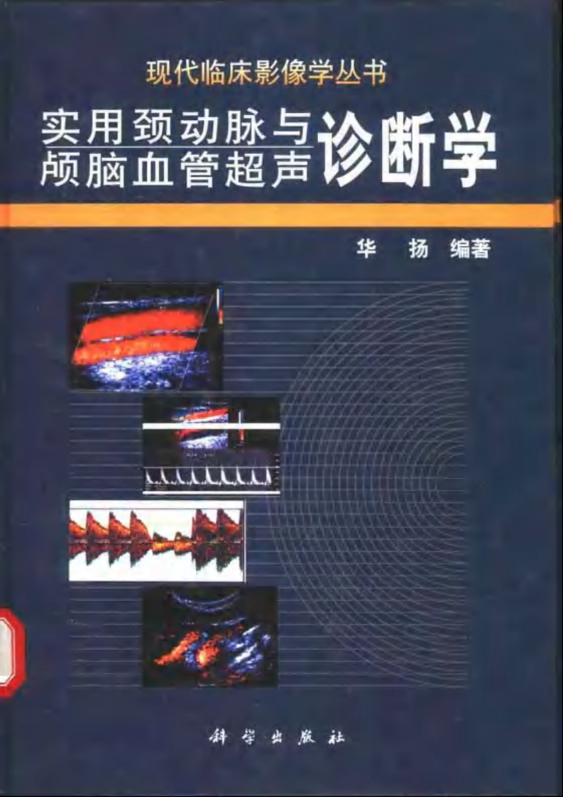 颈动脉与颅脑血管超声诊断学（扫描版）.pdf 第1页