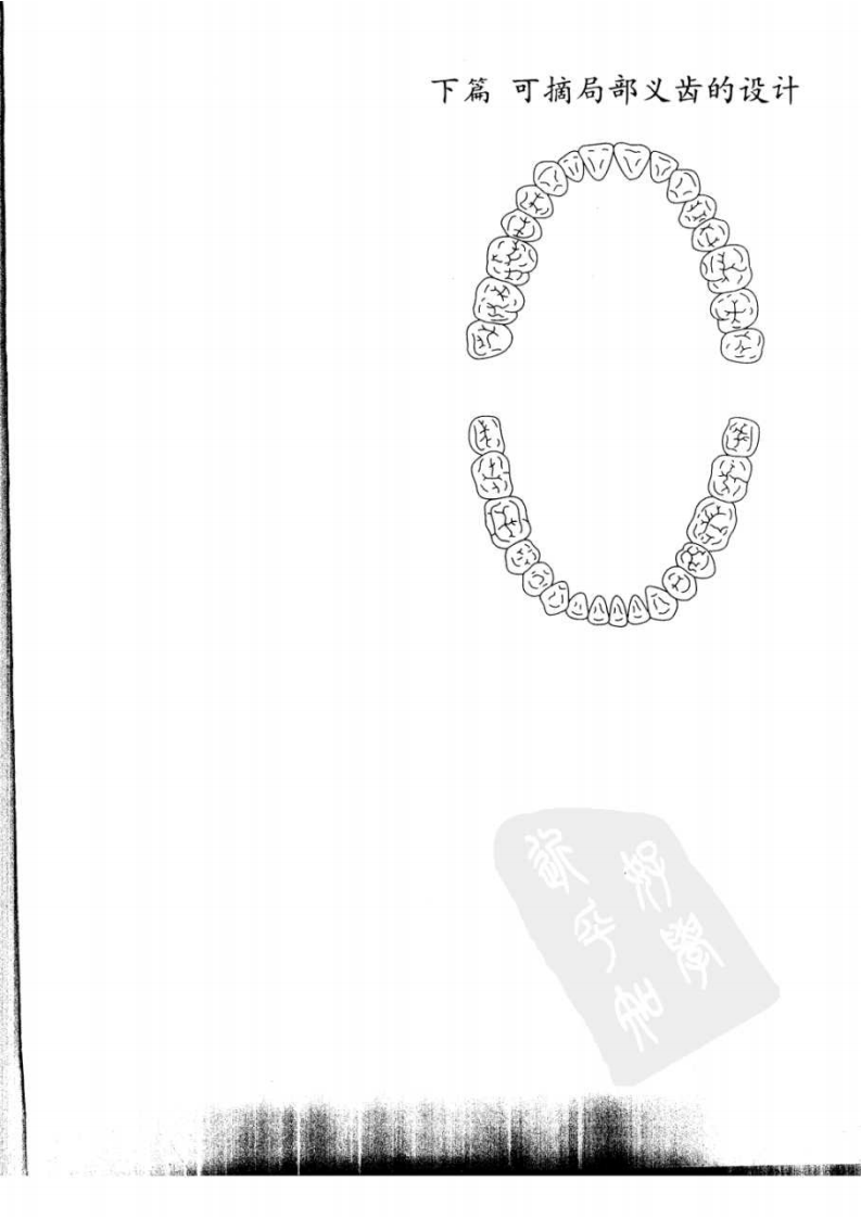总义齿与可摘局部义齿的设计++（下册）.pdf 第4页