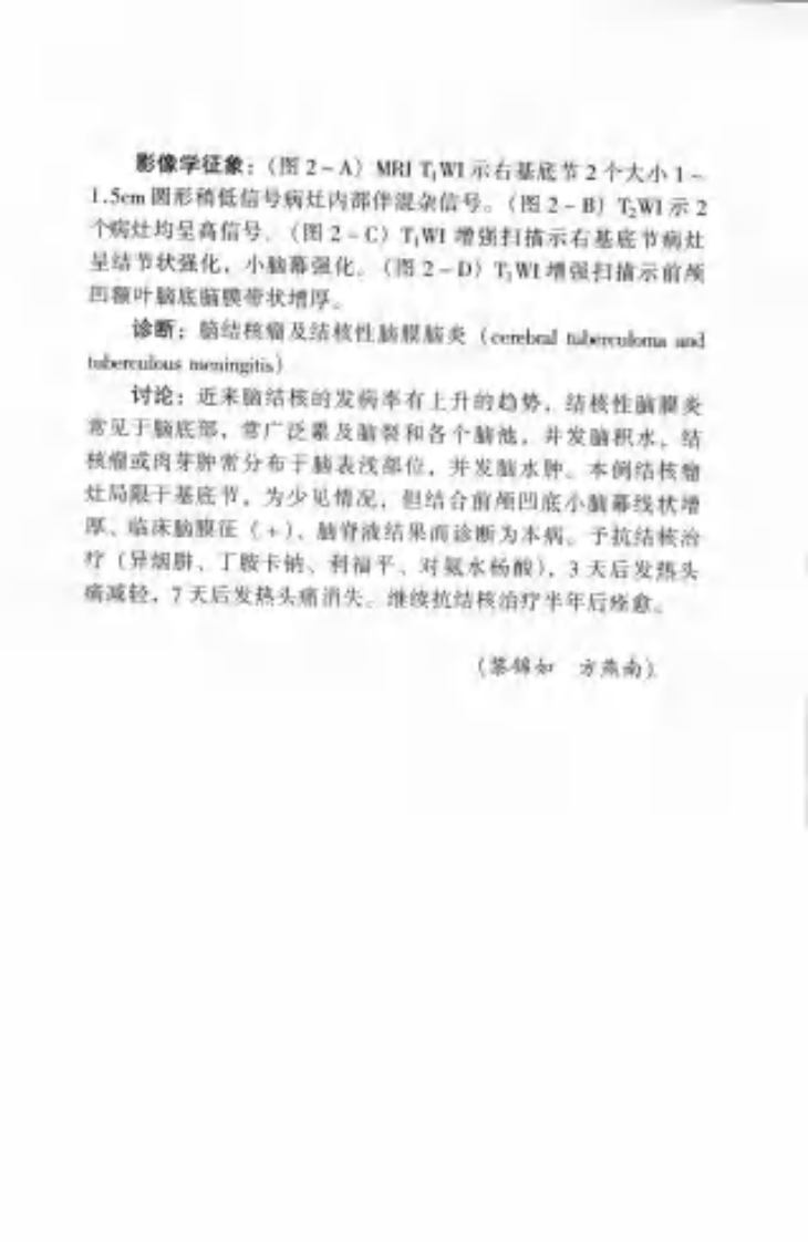 神经科疑难病例影像诊断分析（扫描版）.pdf 第4页