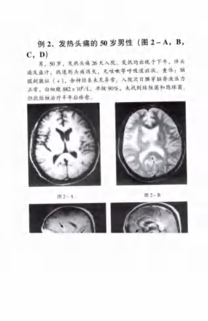 神经科疑难病例影像诊断分析（扫描版）.pdf 第3页