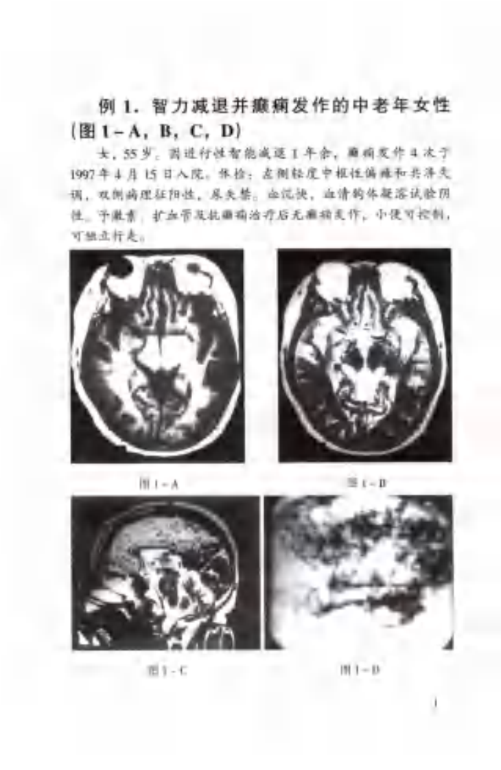 神经科疑难病例影像诊断分析（扫描版）.pdf 第1页