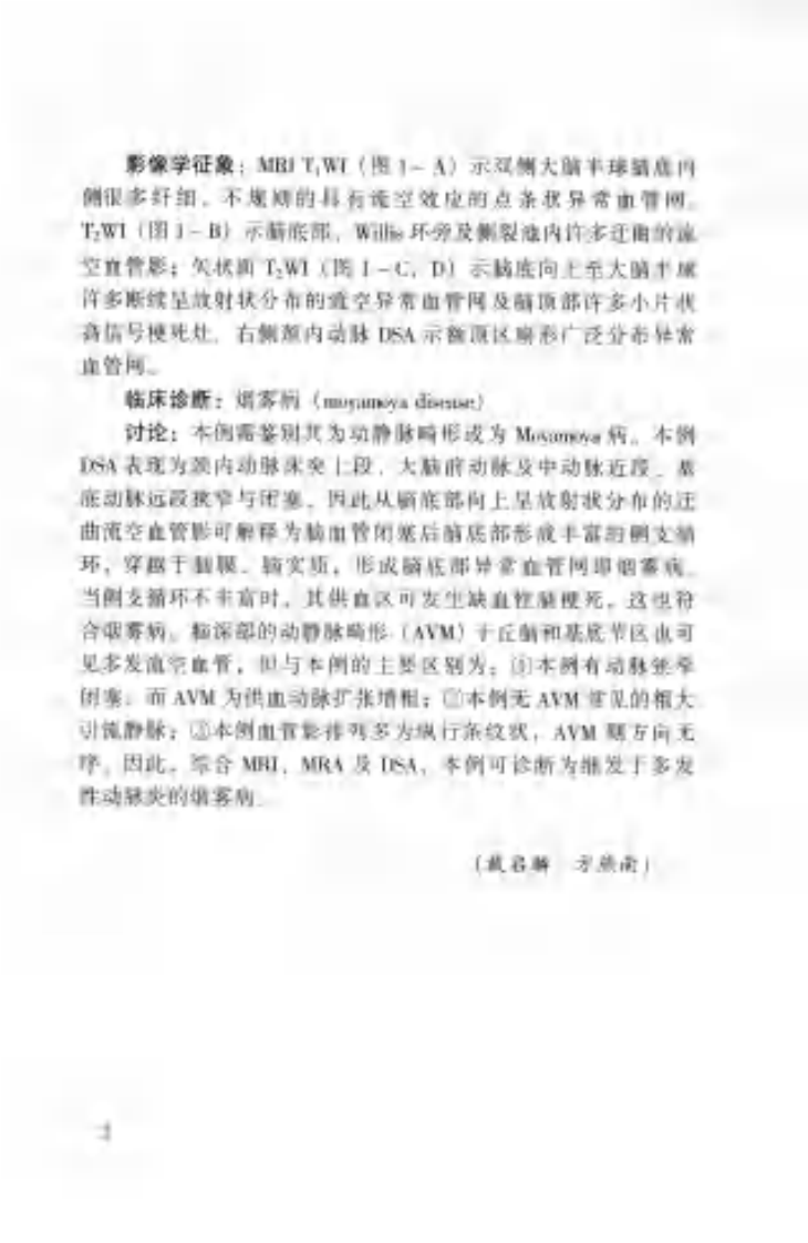 神经科疑难病例影像诊断分析（扫描版）.pdf 第2页