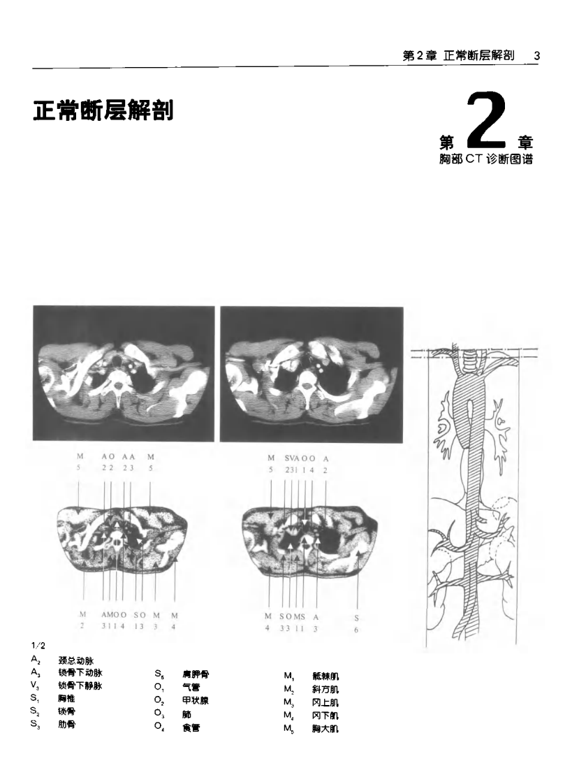 胸部CT诊断图谱.pdf 第5页