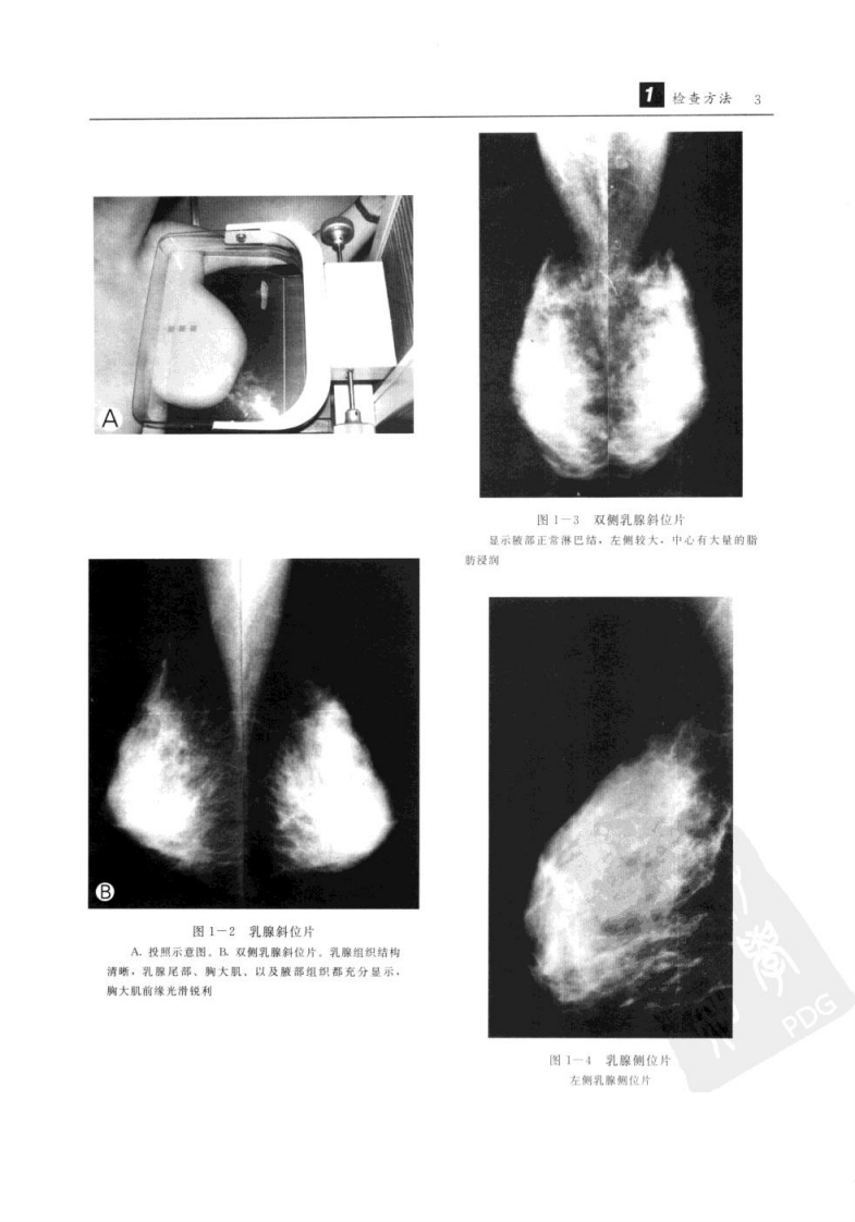 杜红文，张蕴主编.+乳腺疾病影像诊断学.+西安市：陕西科学技术出....pdf 第3页