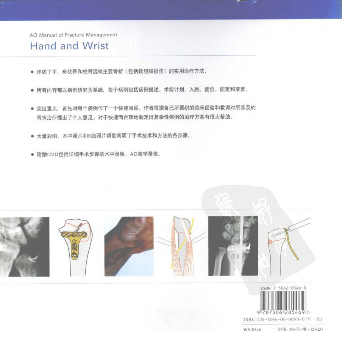 AO-手及腕部骨折处理手册.pdf 第2页