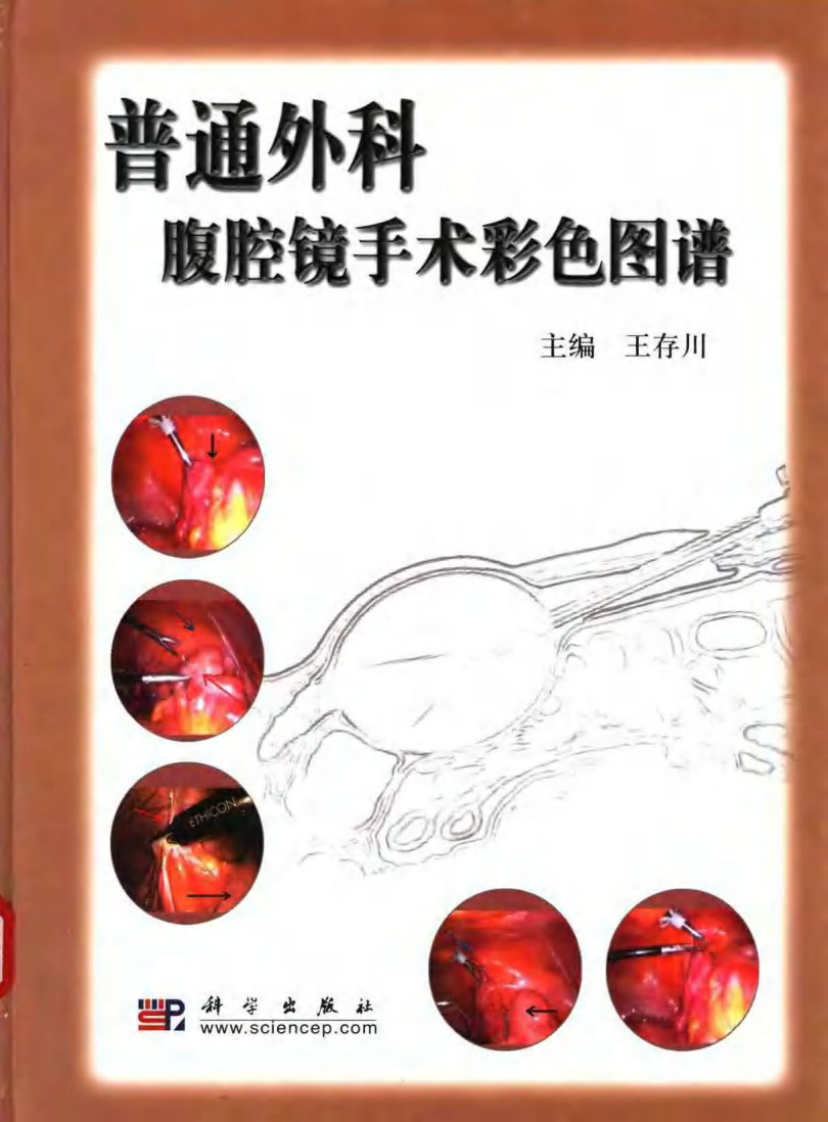 普通外科腹腔镜手术彩色图谱.pdf 第1页