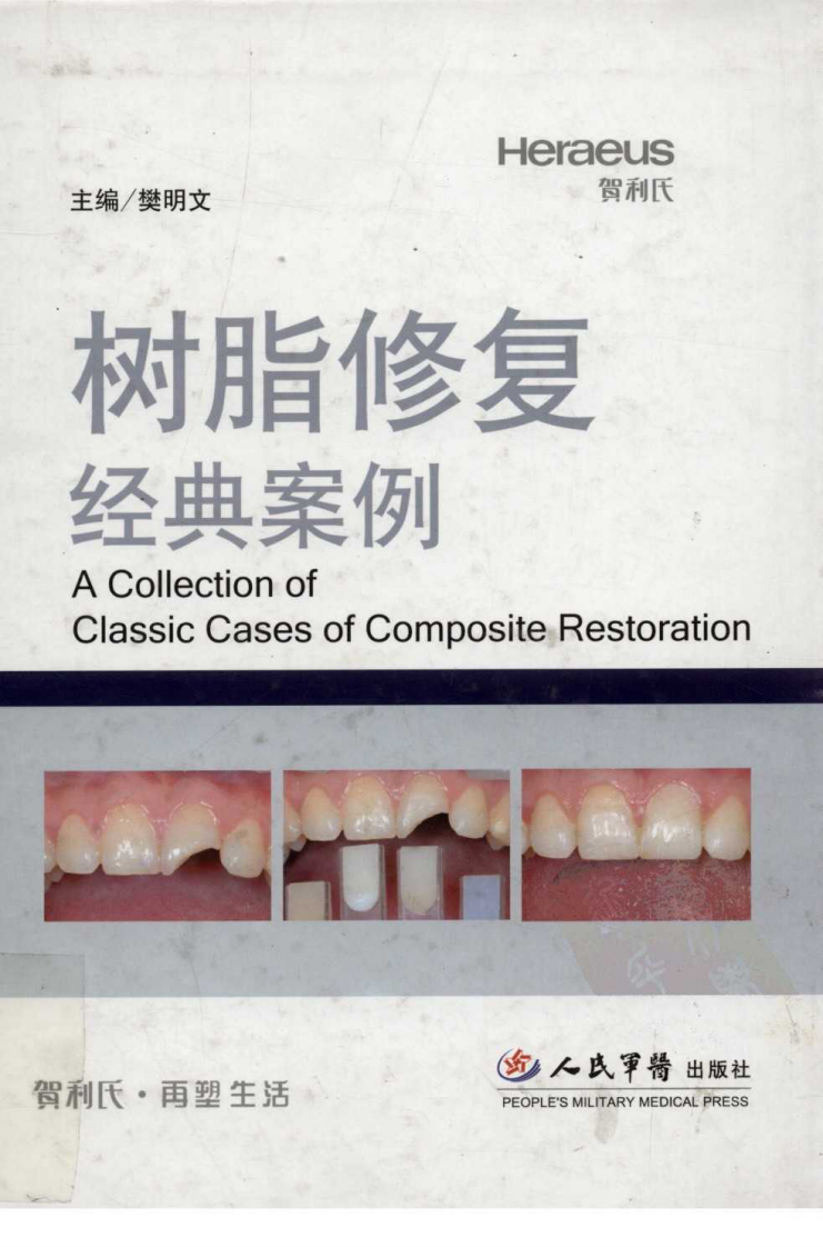 004树脂修复经典案例.pdf 第1页