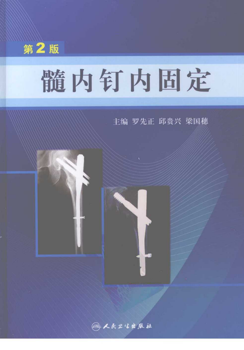 髓内钉内固定  （第2版）  罗先正 2008.pdf 第1页