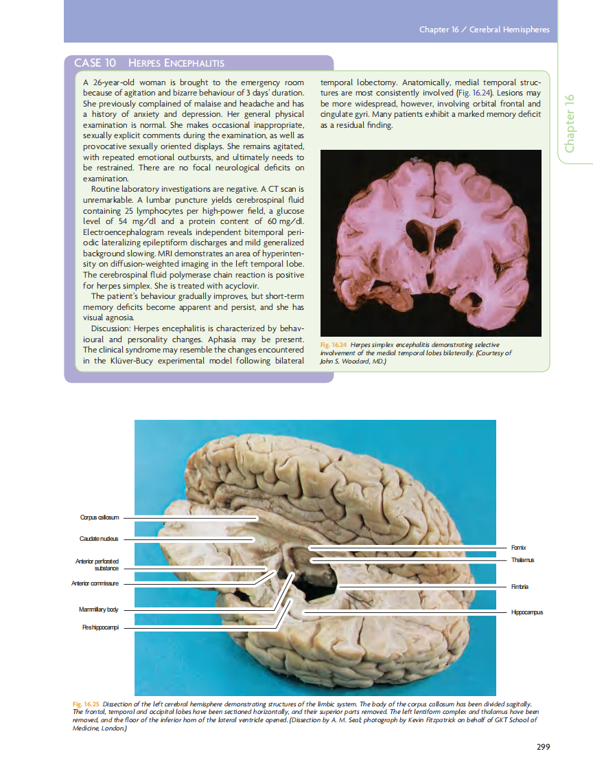 GRAY'S Clinical Neuroanatomy The Anatomic Basis for Clinical Neuroscience_部分13.pdf 第1页